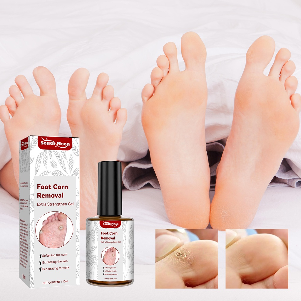 South Moon Foot Corn Removal Extra Strengthen Gel, Hand And Foot Warts And Thorns Calluses Smooth Repair Clean Skin Gel