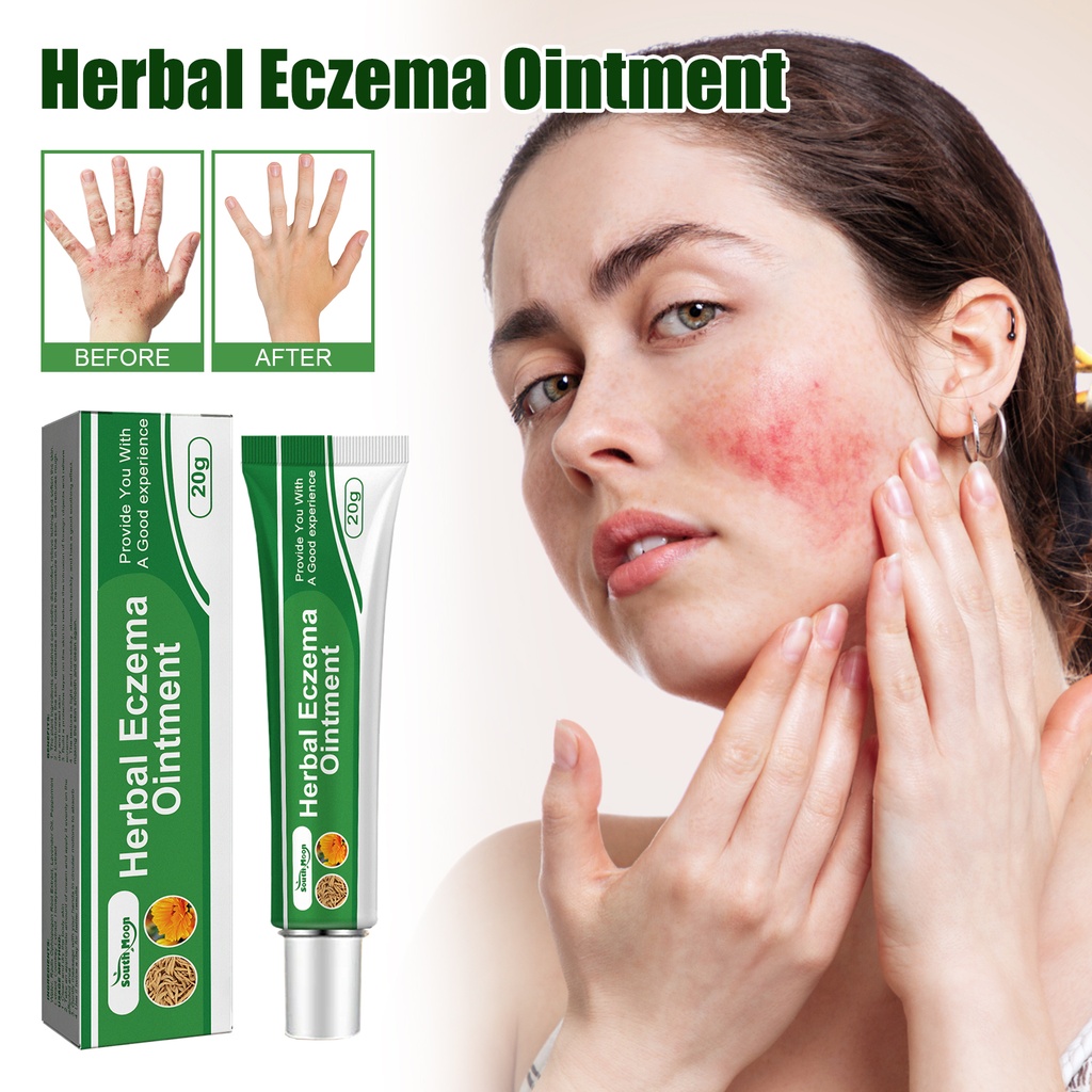 South Moon Herbal Eczema Ointment, Relieve Hand And Foot Moss Skin Redness Itchy Skin Repair Ointment