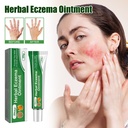 South Moon Herbal Eczema Ointment, Relieve Hand And Foot Moss Skin Redness Itchy Skin Repair Ointment