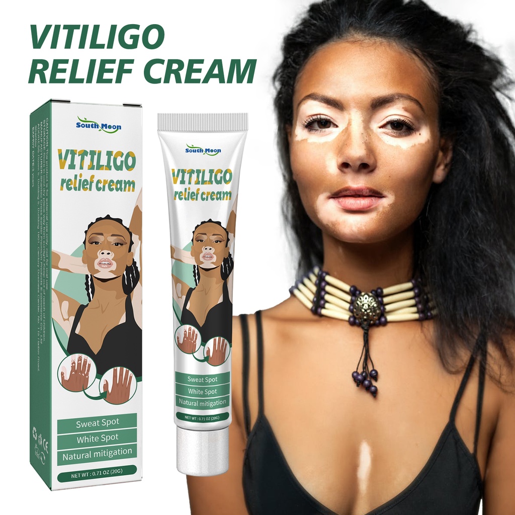 South Moon Vitiligo Relief Cream, Repair White Spots Flower Spots Skin Topical Care Ointment
