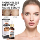 OUHOE Face Brightening Serum, Lighten Dark Spots Moisturizing And Repairing Fine Lines Brightening Serum