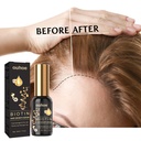 OUHOE Biotin Intensive Hair Essence, Strengthens Hair Repair Hairline And Hydrates Hair Root And Thickening Hair Essence