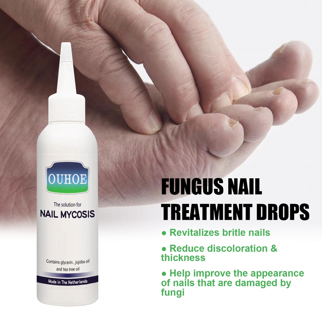 OUHOE Gray Nail Repair Drops, Repair Hand And Foot Gray Nails Soft And Bright Nail Thickening Nail Care Solution