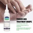 OUHOE Gray Nail Repair Drops, Repair Hand And Foot Gray Nails Soft And Bright Nail Thickening Nail Care Solution
