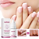 OUHOE Ginger Nail Care Essence, Gray Nail Moisturizing Care Exfoliating Beauty Nail Essence