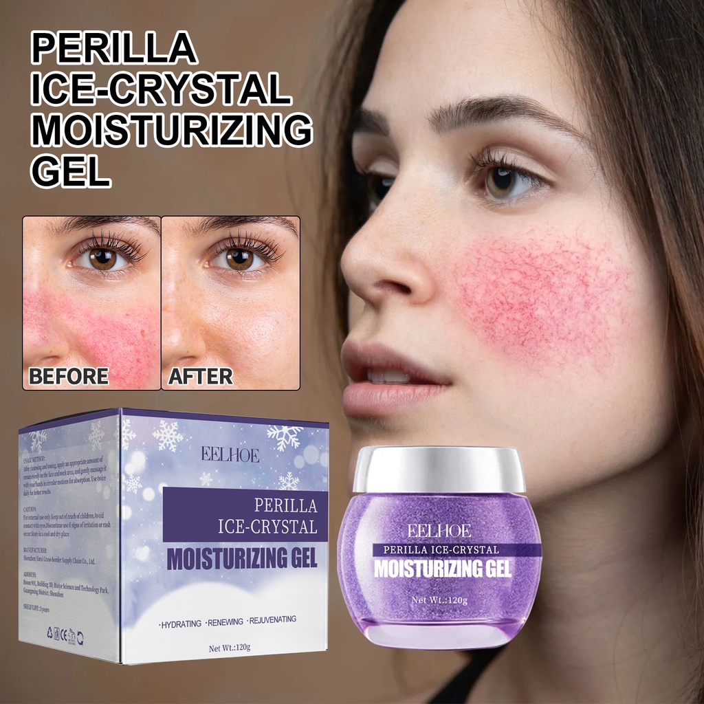 EELHOE Perilla Ice-crystal Moisturizing Gel, Repair Fade Acne Mark Cleansing And Moisturizing Gel