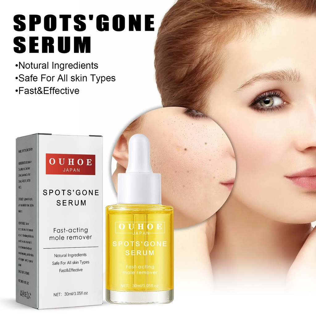OUHOE Blemish Essence, Hydrates Brightening And Whitening Skin, Lightening Dark Spots And Acne Anti-Aging Essence