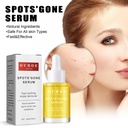 OUHOE Blemish Essence, Hydrates Brightening And Whitening Skin, Lightening Dark Spots And Acne Anti-Aging Essence