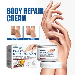 South Moon Body Repair Cream, Relieve Peeling Improve Chapped Dry Skin And Remove Dead Skin Moisturize Cream
