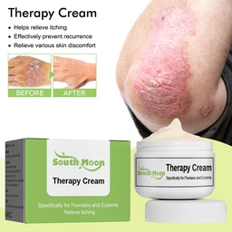 South Moon Therapy Cream, Repair Hand And Foot Skin Moss Smooth Skin Relief Itchy Skin Repair Cream