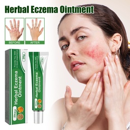 South Moon Herbal Eczema Ointment, Relieve Hand And Foot Moss Skin Redness Itchy Skin Repair Ointment