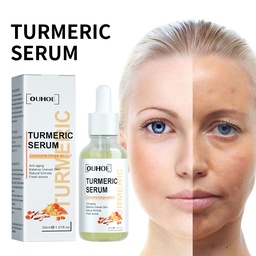OUHOE Turmeric Facial Repair Essence, Skin Repair Remove Dark Spots Anti-Wrinkle And Moisturize Essence