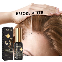 OUHOE Biotin Intensive Hair Essence, Strengthens Hair Repair Hairline And Hydrates Hair Root And Thickening Hair Essence