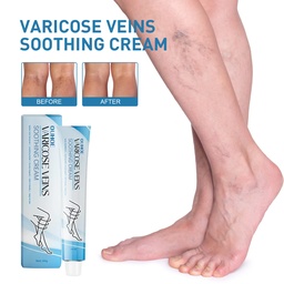 OUHOE Vein Repair Cream, Massage Legs Relieve Leg Pain Varicose Veins Treatment Cream