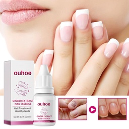 OUHOE Ginger Nail Care Essence, Gray Nail Moisturizing Care Exfoliating Beauty Nail Essence