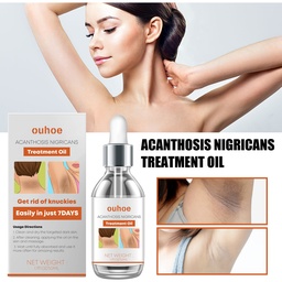OUHOE Black Wattle Essential Oil, Repair Underarm Joint Black Whitening Skin Light Spots Skin Beauty Essence Oil