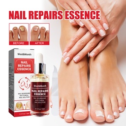 West&Month Nail Repair Essence, Repair Gray Nails Bright Nails Soft Nails Clean Nails Care Solution