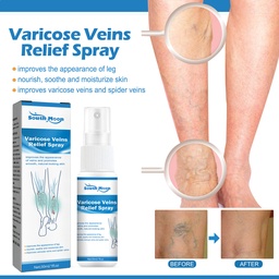 South Moon Varicose Veins Relief Spray, Varicose Repair Soreness And Swelling Body Care To Relieve Earthworm Legs Massage Spray